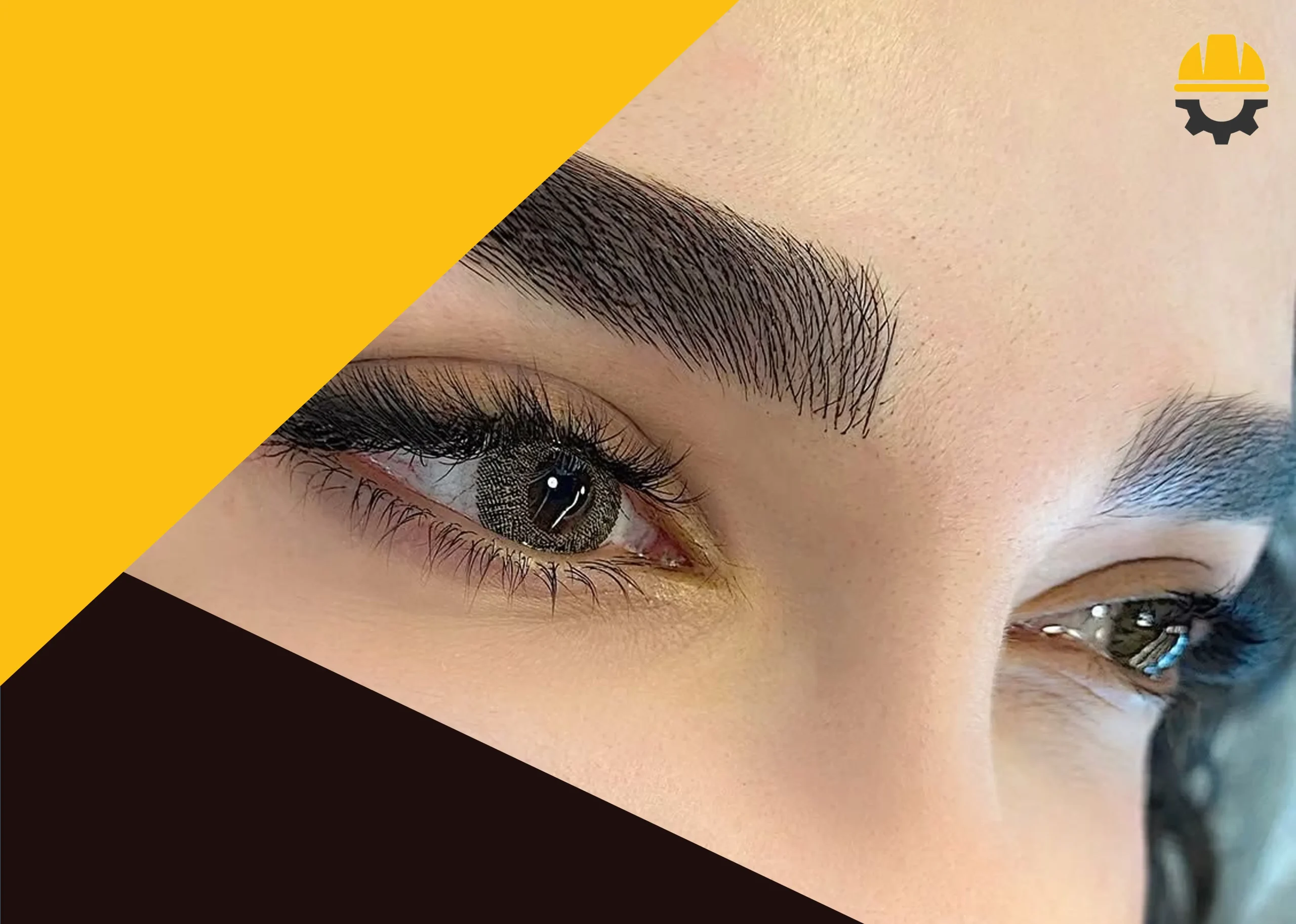 ماندگاری فیبروز ابرو