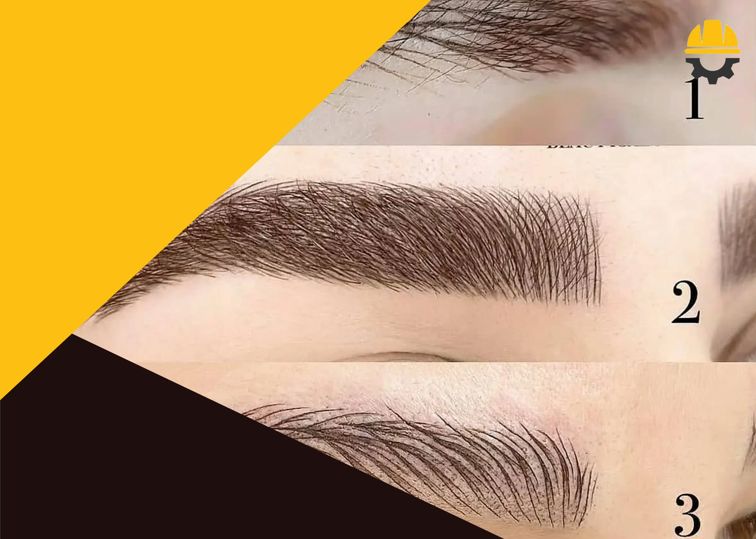 مراحل انجام فیبروز ابرو