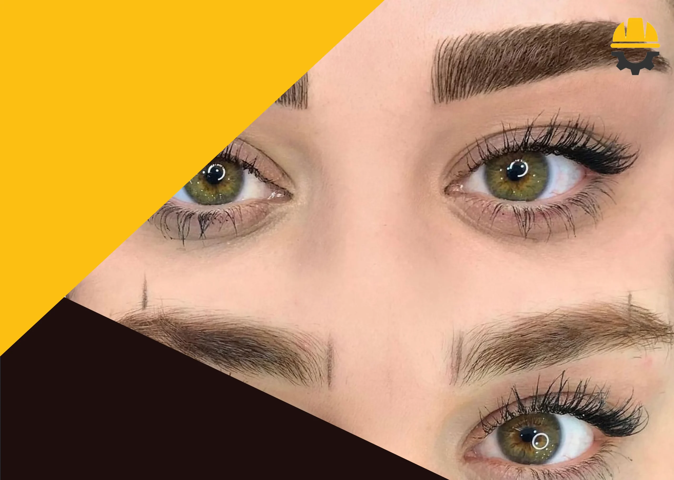 مزایای فیبروز ابرو