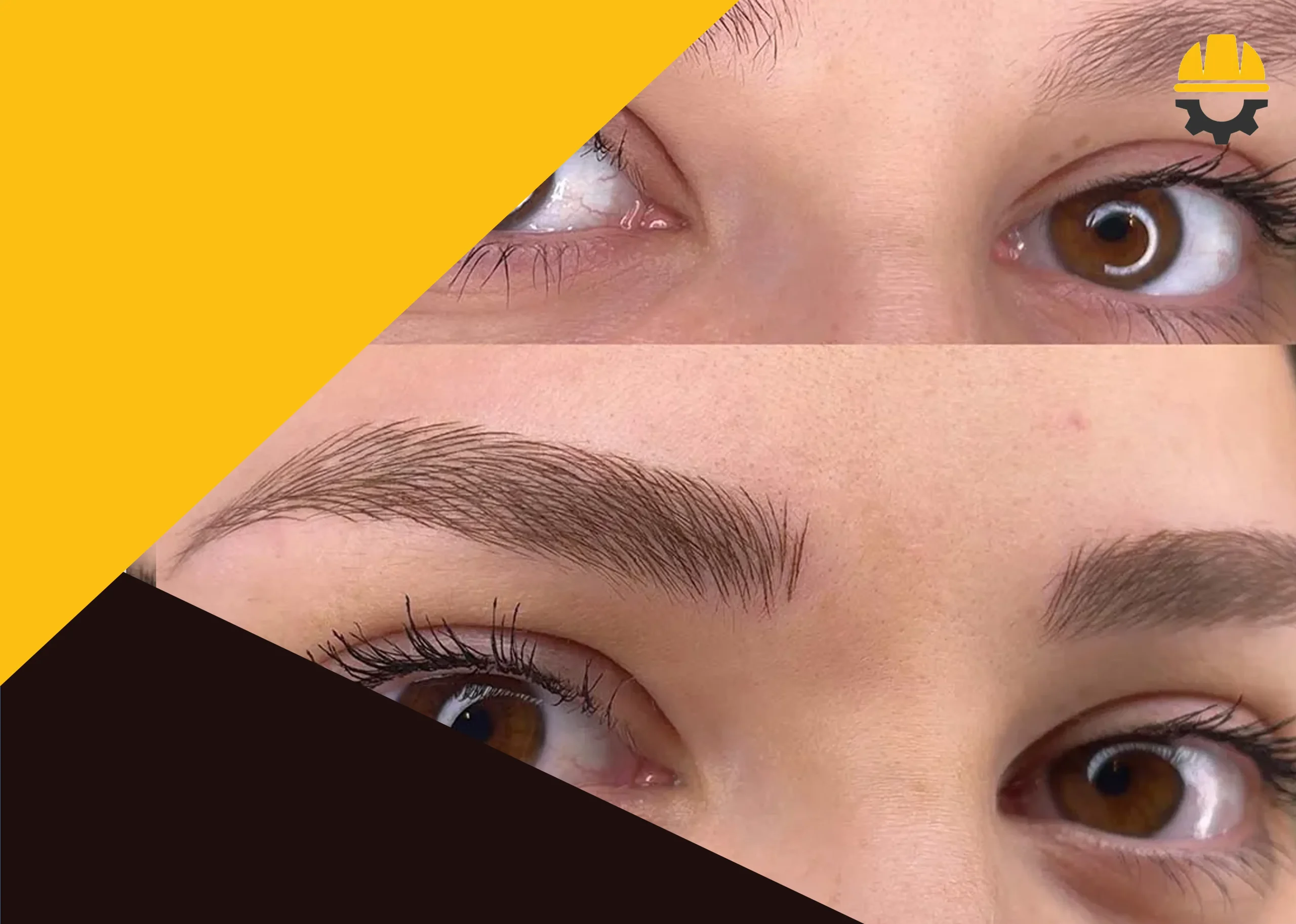 موارد مجاز دریافت خدمات فیبروز ابرو