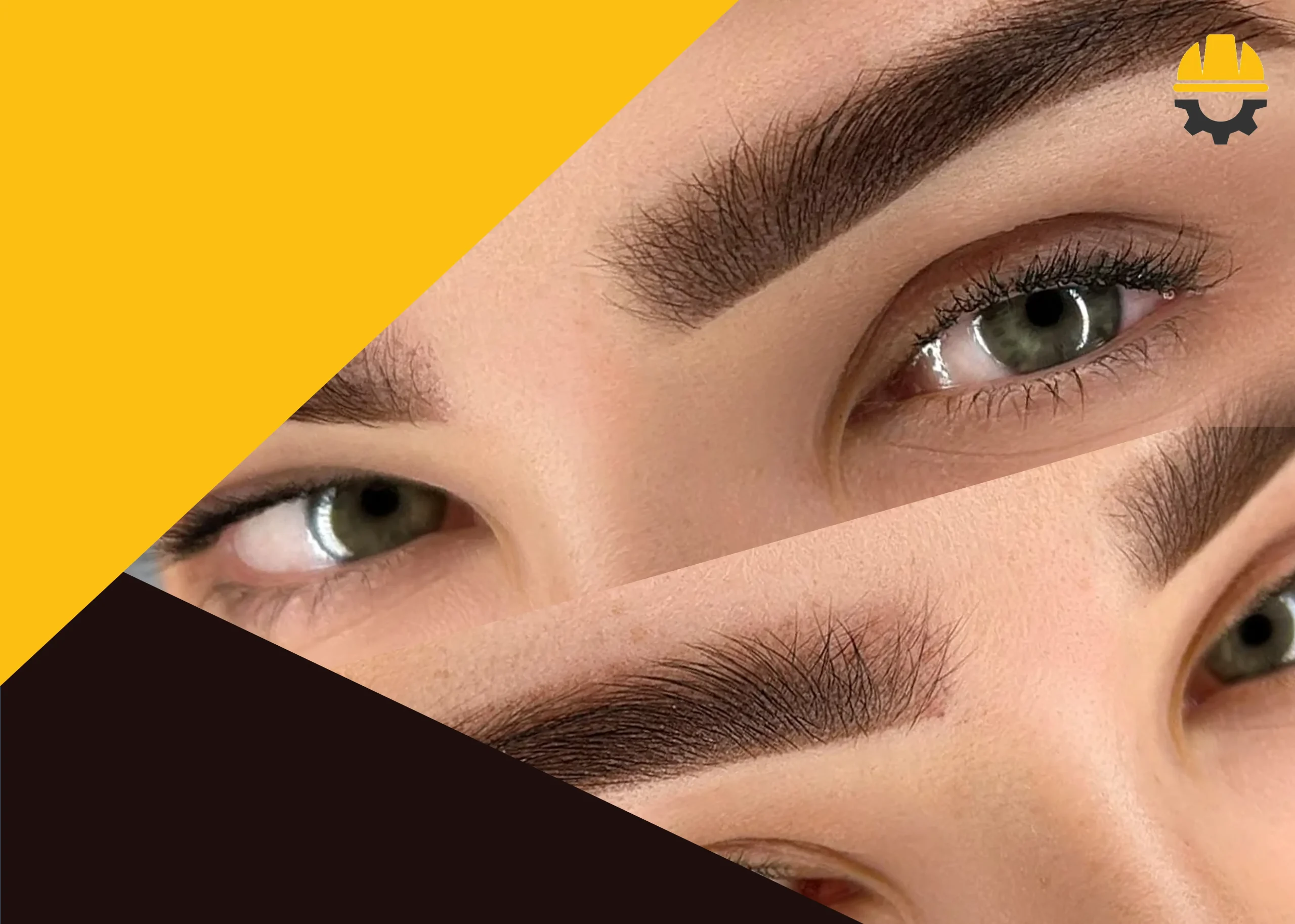 هزینه فیبروز ابرو در شیراز